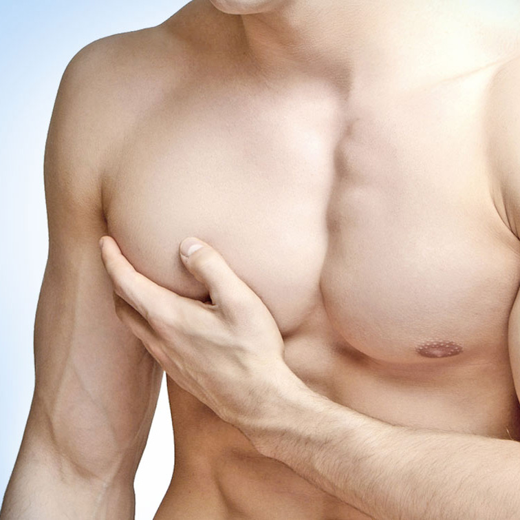 Gynecomastia (Male Chest Reduction)