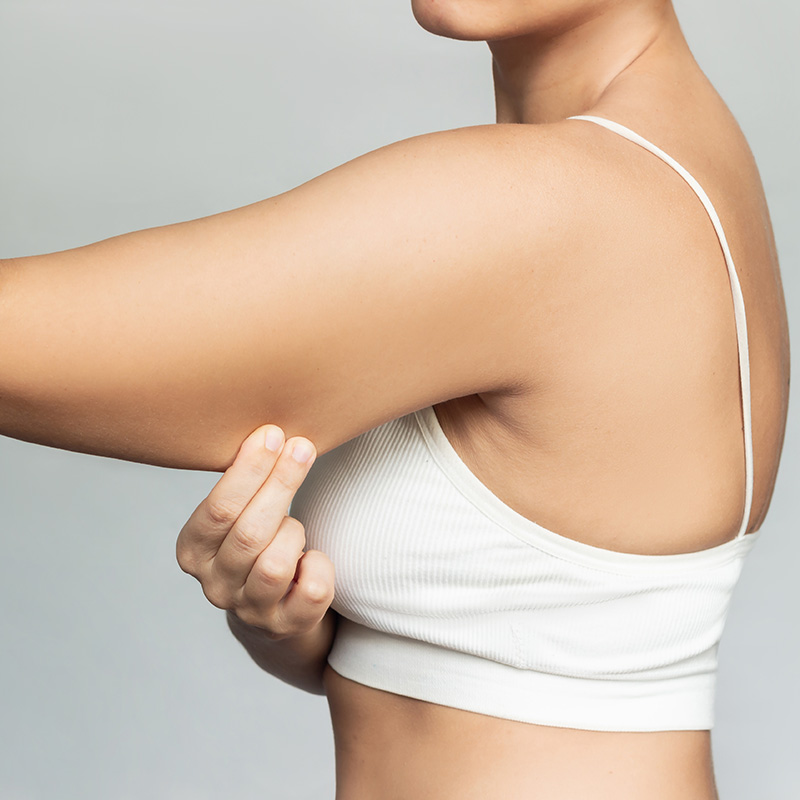 Arm Liposuction