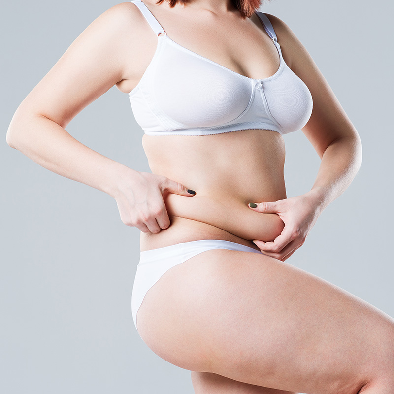 Tummy Tuck